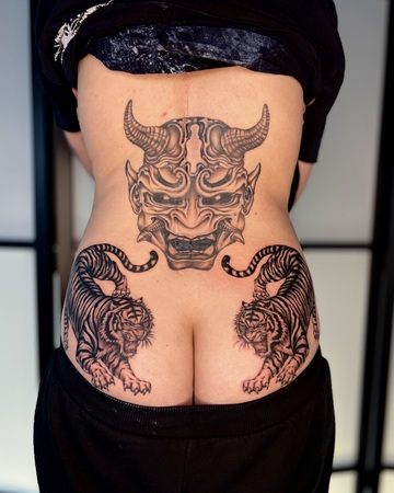 Recouvrement de cicatrice pour Camille